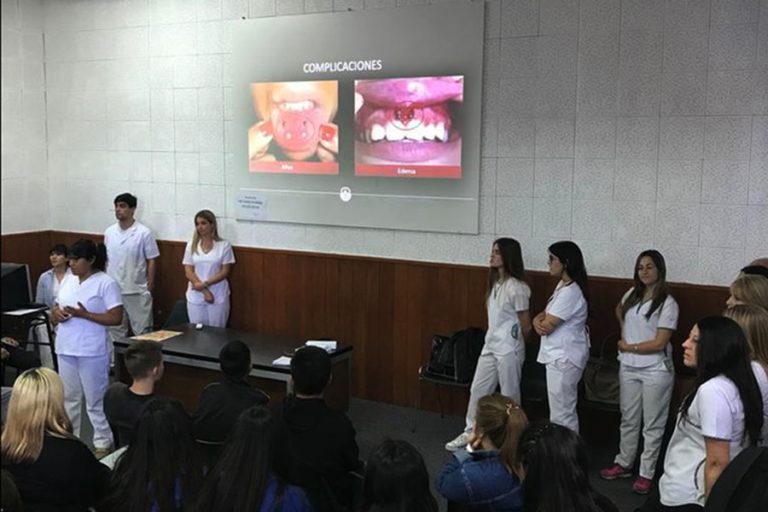 Advertencia de odontólogos por el uso de piercing en la boca