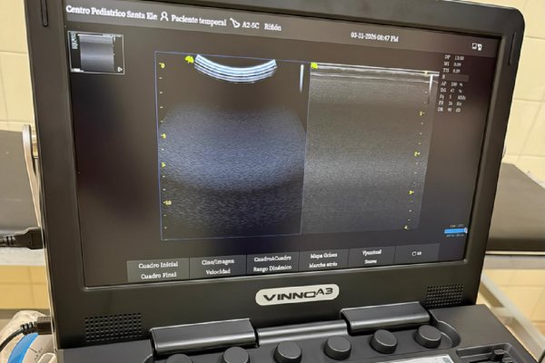 Ecógrafos en tres hospitales: Mejora de la atención sanitaria y diagnóstico preciso